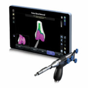 CORI®-robotikgestützte Kniechirurgie – Wie Roboter dem Gelenk helfen