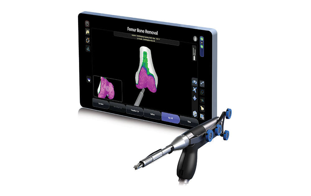 CORI®-robotikgestützte Kniechirurgie – Wie Roboter dem Gelenk helfen